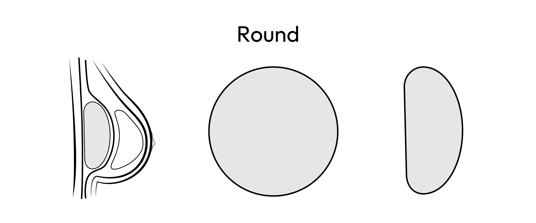 Round Breast Implants